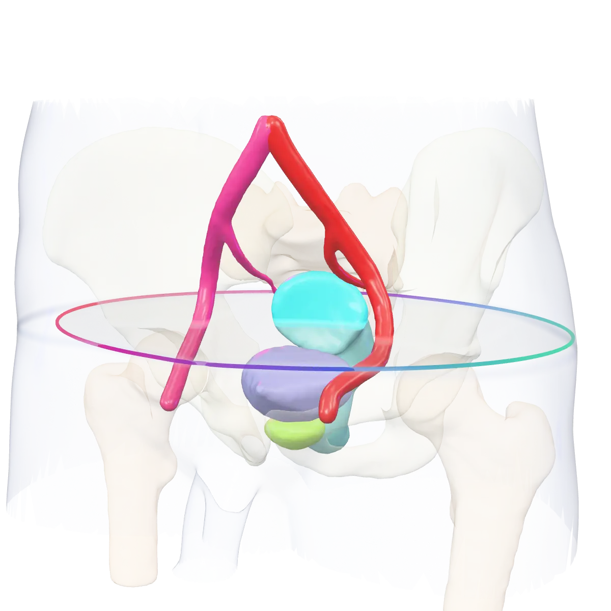 Pelvis en trois dimensions issu d’un atlas public : vessie, prostate, vésicules séminales, rectum, os du bassin, sacrum, fémurs et artères iliaques dans un bassin translucide.