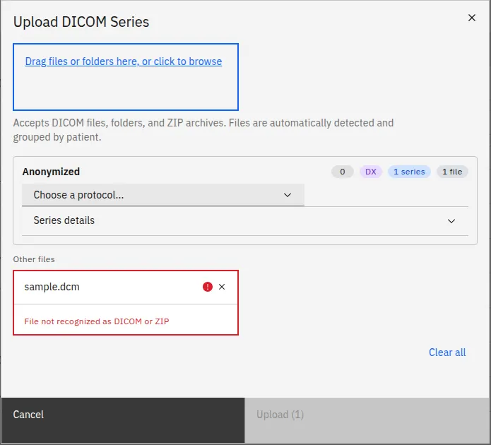 Boîte de dialogue d’import de séries DICOM avec une zone de dépôt pour fichiers .dcm et .zip et la liste des séries détectées